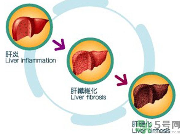 在外面吃飯會得乙肝嗎？在食堂吃飯會得乙肝嗎？