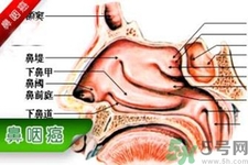 鼻咽癌是什么？鼻咽癌的癥狀有哪些？