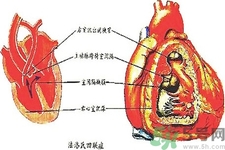 先天性心臟病可以用藥物治療嗎？