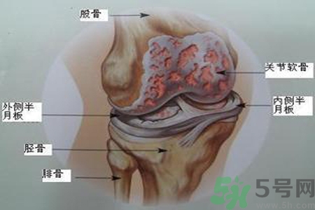 預防骨病需要注意哪些姿勢？秋季預防骨病的方法有哪些？