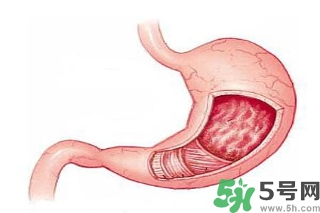 急性腸胃炎哪些食物不可以吃？急性腸胃炎不能吃的水果有？