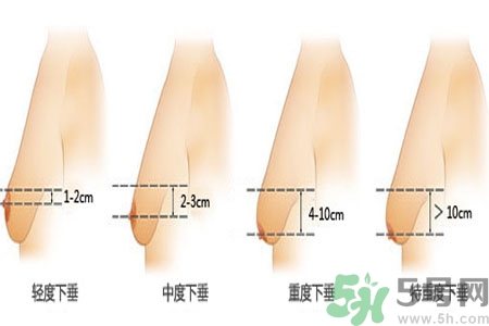 胸部松弛的原因是什么？胸部松弛該怎么辦？