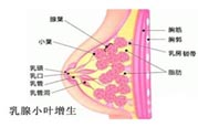 乳腺增生治療方法是什么？乳腺增生的檢查方法有哪些？