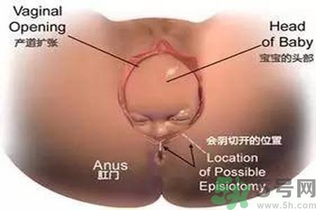 女性陰道松弛的原因是什么？女性陰道松弛怎么辦？