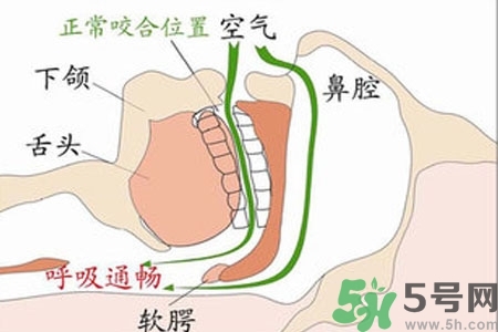 鼻子紅是什么原因？鼻子紅怎么辦？