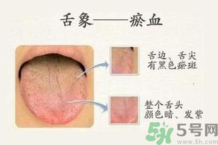 血瘀體質吃什么？血瘀體質怎么調理？