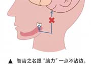 長智齒疼痛怎么辦？長智齒牙齦腫了怎么辦？