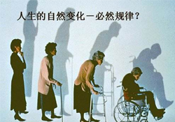 哪些人容易得骨質(zhì)疏松癥？骨質(zhì)疏松的高發(fā)人群有哪些？