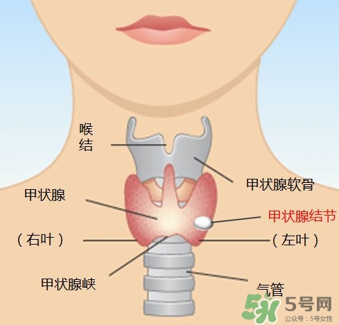 甲狀腺結(jié)節(jié)如何治療 甲狀腺結(jié)節(jié)的癥狀