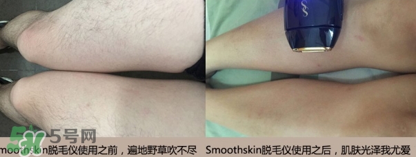 smoothskin和slikn infinity哪個好？smoothskin脫毛儀怎么樣