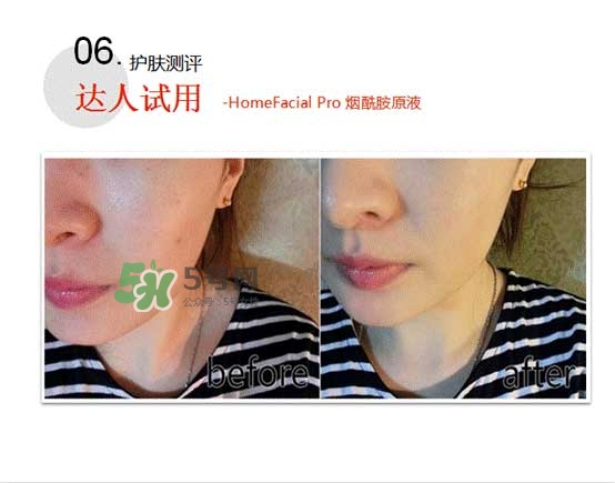 homefacialpro煙酰胺原液怎么樣？hfp煙酰胺原液好用嗎