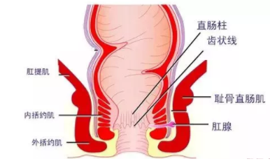 肛瘺非手術治療才可以嗎？手術是治療的關鍵途徑