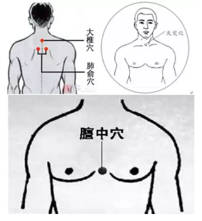 吮痧有什么療效？最溫柔的治病方法