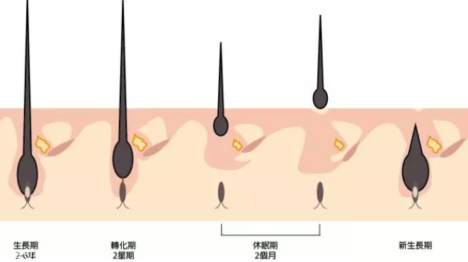 頭發(fā)為什么會(huì)掉？毛囊想休息了