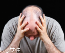 脫發(fā)有沒有治？只要不是禿子就有得治