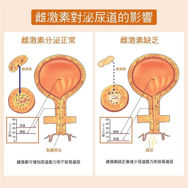 更年期尿失禁怎么辦 泌尿道困擾怎么改善