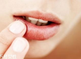 嘴唇上長(zhǎng)泡不疼怎么辦 7種方法教你解決