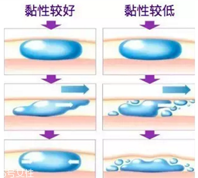 伊婉玻尿酸有幾個型號 伊婉c型和v型的區別