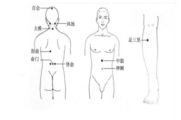 中醫針灸療法中艾灸 能有效治療頭痛癥狀