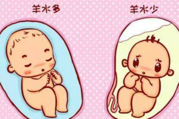 孕婦羊水過多什么癥狀 媽媽們要注意