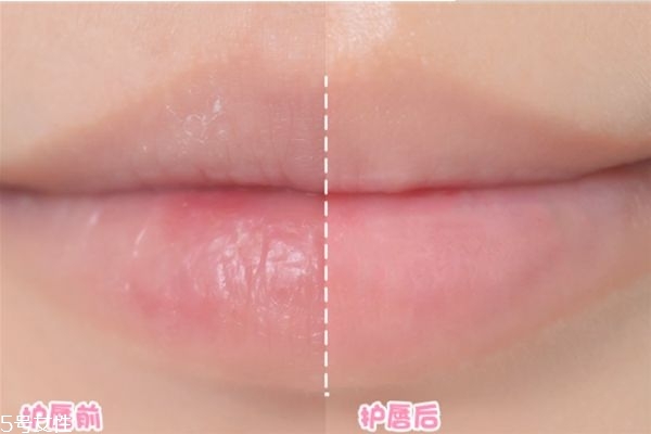 泰國(guó)唇膜cibio好用嗎 cibio2唇膜孕婦能用嗎