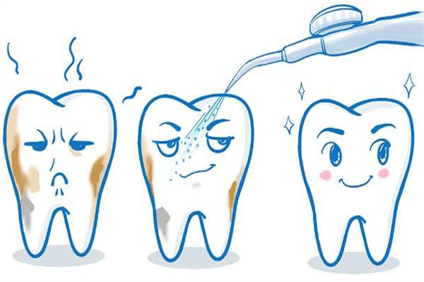 為什么洗牙有異物感 洗牙的誤區
