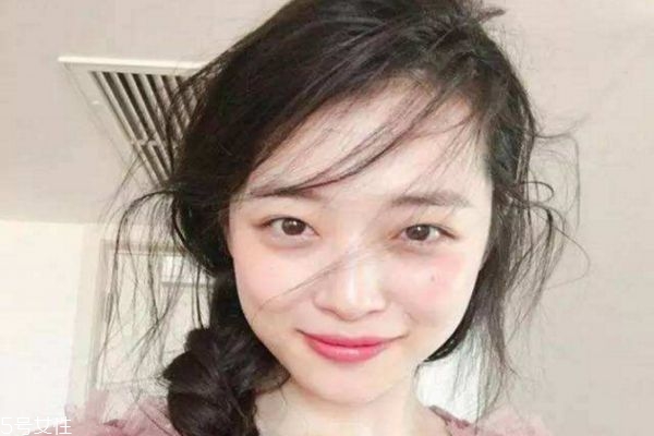 彩光嫩膚后怎么保養 彩光嫩膚術后注意事項