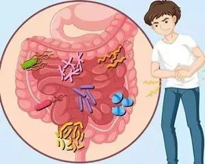 輕度結腸炎可以不治療嗎 輕度結腸炎需要治療嗎