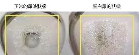 腎不好的人有什么表現 人腎不好身體有什么反應