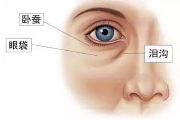 眼袋能熱敷嗎 眼袋是熱敷還是冷敷