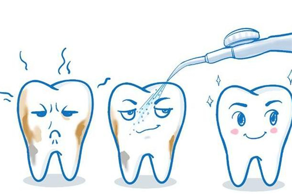 洗牙有必要洗牙根內(nèi)部嗎 洗牙洗的是什么