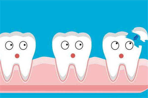 補牙前封牙是什么意思 補牙前為什么要塞藥一個星期