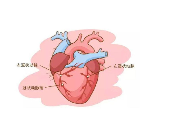 心肌炎是什么原因造成的 心肌炎是心臟病嗎